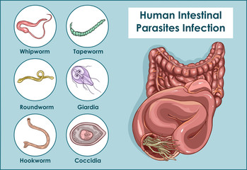 Vector Illustration of a Human Intestinal Parasites - obrazy, fototapety, plakaty