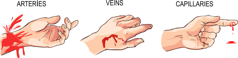 vector illustration of a  Arterial and venous bleeding