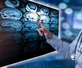 doctor pointing finger to CT scan
