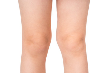 Knees of little baby isolated on white