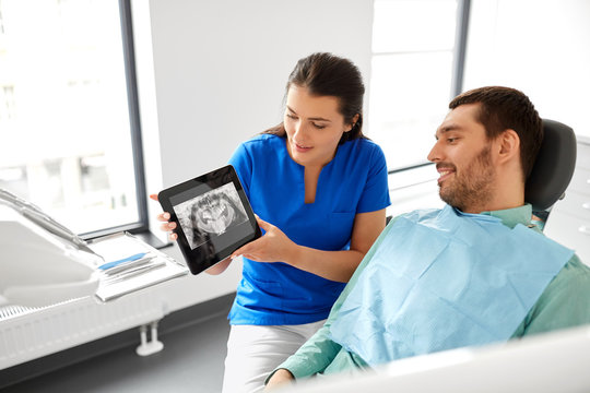 medicine, dentistry and healthcare concept - female dentist showing teeth panoramic x-ray scan on tablet pc computer to male patient at dental clinic