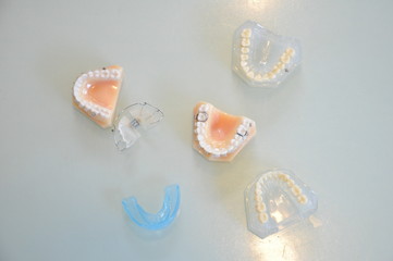 歯科模型と矯正装置