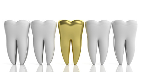 White tooth models and one gold isolated on white background. 3d illustration