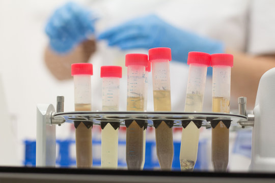 Laboratory testing