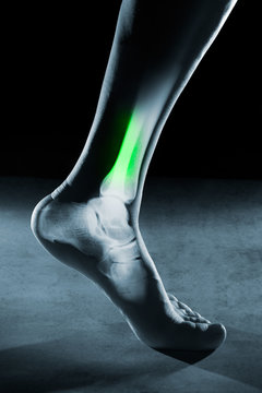 Human foot ankle and leg in x-ray, on gray background. The foot ankle is highlighted by green colour.