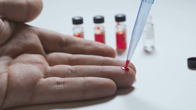 Doctor taking blood sample from male hand at lab.