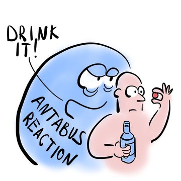 Man and antabus reaction