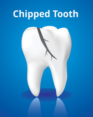 Chipped tooth, Dental care concept, Realistic design illustration Vector.