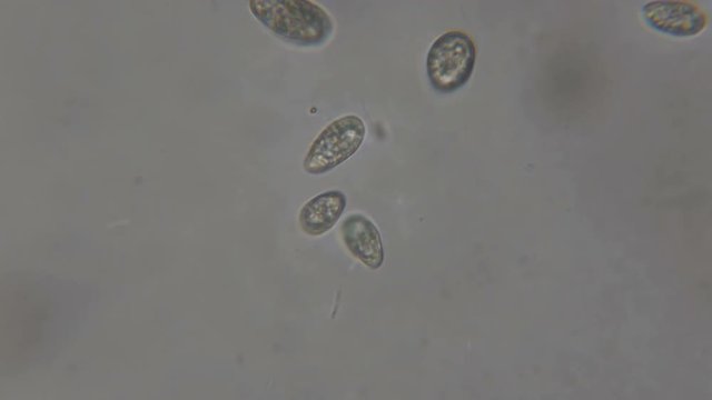 Motion of single-celled animals (infusoria) under microscope. Colony of ciliates Stylonychia under the microscope in lake water. Close up. UHD 4K