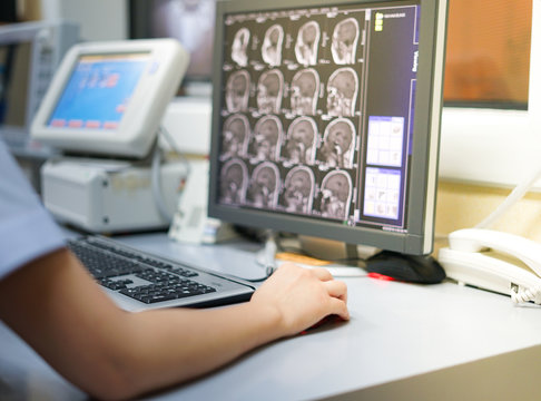 Radiotechnologist hand holding mouse while working on Magnetic Resonance Imaging(MRI) room workstation, Sagittal plane of MRI brain image is background, Medical concept