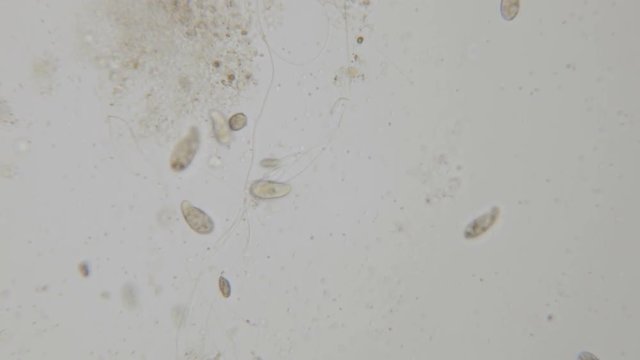 Motion of single-celled animals (infusoria) under microscope. Colony of ciliates Stylonychia under the microscope in lake water. Close up. UHD 4K