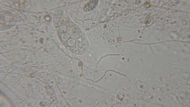 Motion of single-celled animals (infusoria) under microscope. Colony of ciliates Stylonychia under the microscope in lake water. Close up. UHD 4K