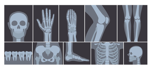 Vector illustration of realistic set of many X-rays pictures of human body. Transparent X-ray photos on white background. - obrazy, fototapety, plakaty