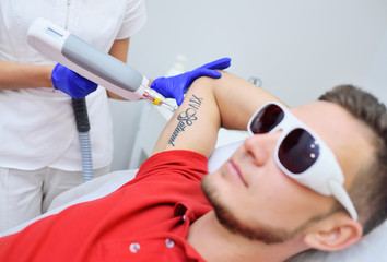 The Cosmetologist removes the patient's tattoo with a neodymium laser.