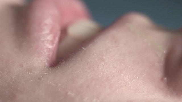 Extremely close-up, painful epilation of a female face, adhesive wax strips