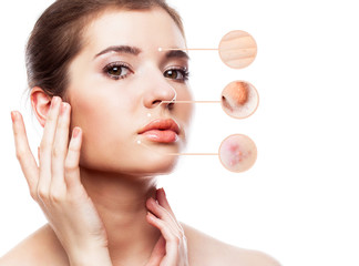 Portrait of young beautiful woman with problem and clean skin. Aging and youth concept. Parts of...
