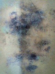 Blue and black mold