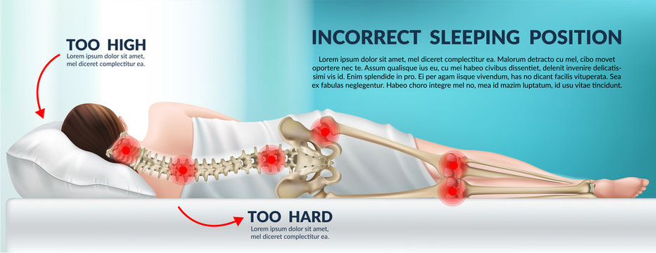 Advertising poster incorrect posture for sleep on a high pillow and hard mattress. Wrong position cervical vertebrae and knees. 3d realistic vector illustration.