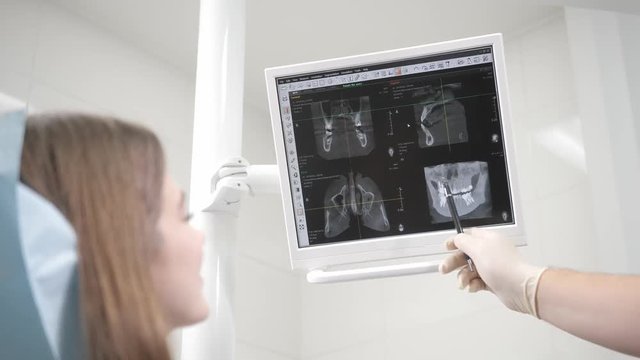 the doctor shows a picture of the x-ray on the monitor. Portrait of a young beautiful girl in the dentist chair at dental clinic. Medicine, health, stomatology concept. dentist treating a patient.