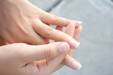 Image of a broken nail hand