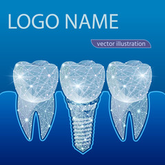 Healthy teeth and dental implant. Dentistry. Implantation of human teeth. Vector illustration