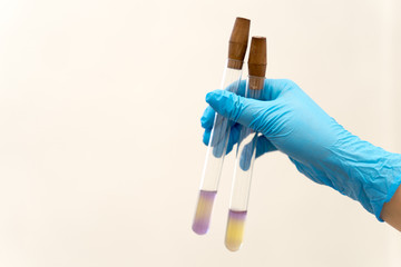 hand in glove holding test tube