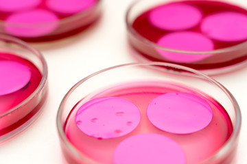 Petri dishPetri dish