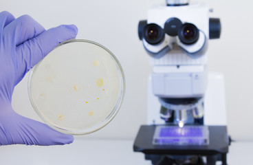 Close-up of a scientist's hand holding a petri dish against a microscope background. Laboratory microscope. Study of bacteria under a microscope. Bacteria from a medical tablet.