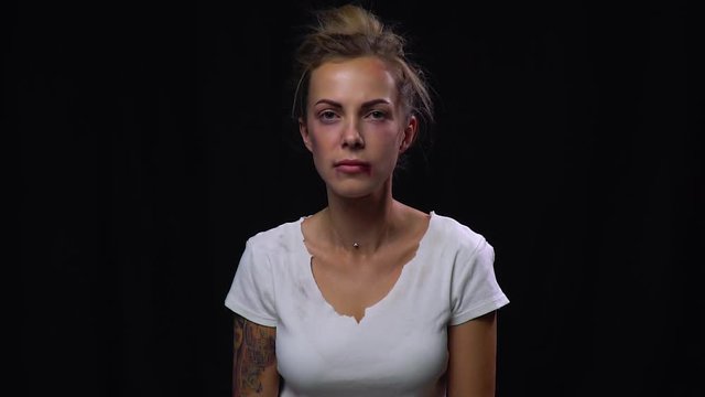 Beaten up woman on the verge of tears, social issues, domestic violence