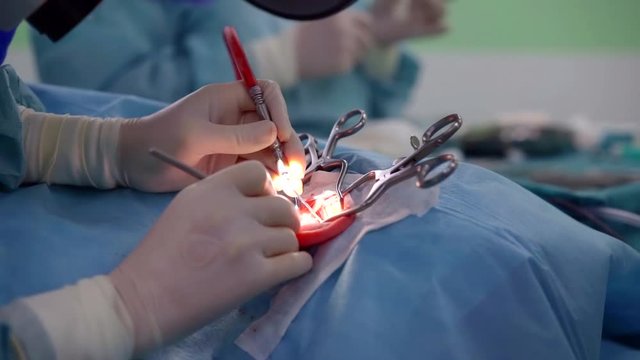 close-up view of ear of patient in surgery room, extenders are fixing, installing a hearing aid