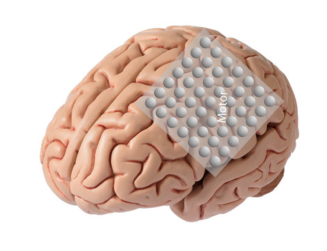 Brain model with graphic of electrode recording covering motor cortex
