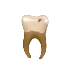 Old sick human tooth with caries isolated on white