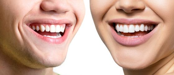 Beautiful wide smiles with great healthy white teeth of laughing man and woman. Smiling happy people. Laughing female and male mouths. Teeth health, whitening, prosthetics and care.