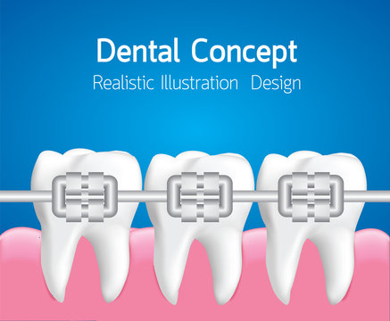 Dental care concept, Realistic illustration Vector