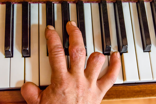 Injured male hand on the shiny piano keys. Top view
