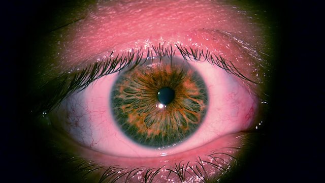 Macro Close-up eye blinking,  Human eye close up macro, eye disease close up, Close up of cornea during eye examination, blepharitis of eye close up