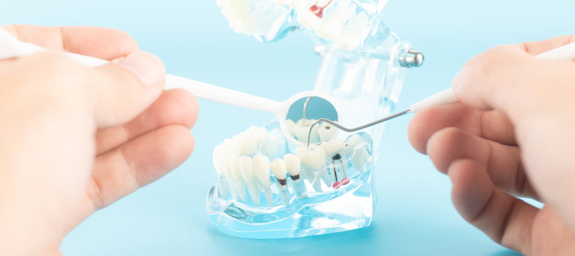 Dental check up with dental model in oral health care concept.