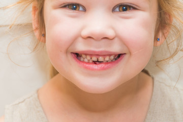 a girl, a child lost a tooth, hole, oral hygiene