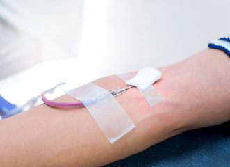 Needle for blood donation. Medical Equipment for blood donor at donation, transfusion. Close up arm of a receiving blood in hospital. Also concept image for World blood donor day - June 14