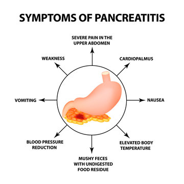 Symptoms of pancreatitis. The structure of the stomach and pancreas. Infographics. Vector illustration on isolated background