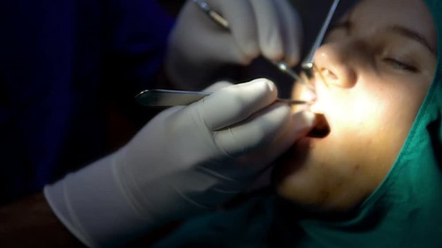 Dental surgeon at operation on female patient, apicoectomy surgery