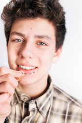 A beautiful teenager smiles on a light background and tries a braces to equalize teeth on the upper jaw. Vertical. Focus on braces © Мар'ян Філь
