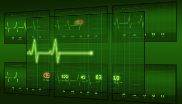 The graph of abnormal heartbeat on the green monitor with the ALARM signal is seen slightly from the side compared to other monitors