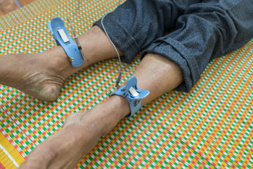 Electrocardiogram equipment making cardiogram test to poor Asian male patient in a volunteer program