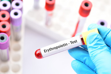 Blood sample tube for erythropoietin test, stimulate hormone for red blood cell production 
