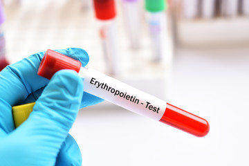 Fototapeta premium Blood sample tube for erythropoietin test, stimulate hormone for red blood cell production 