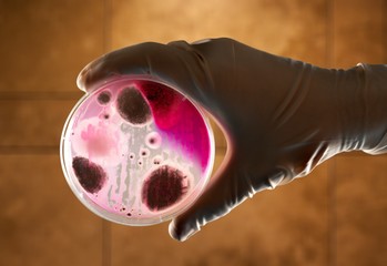 Anthrax bacterium petri dish microbiology science plate pathogen
