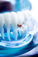 Dentist dental teeth model