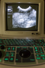 Digital ultrasound