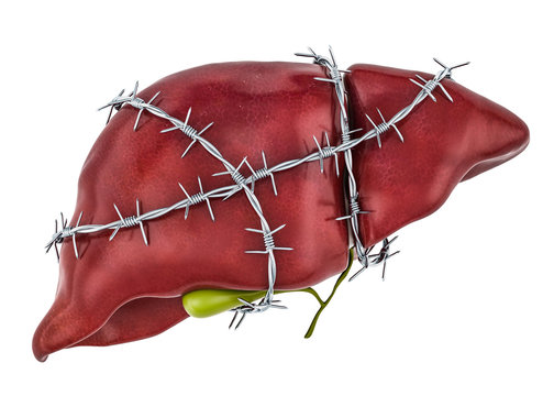 Liver Pain concept. Human liver with barbed wire. 3D rendering